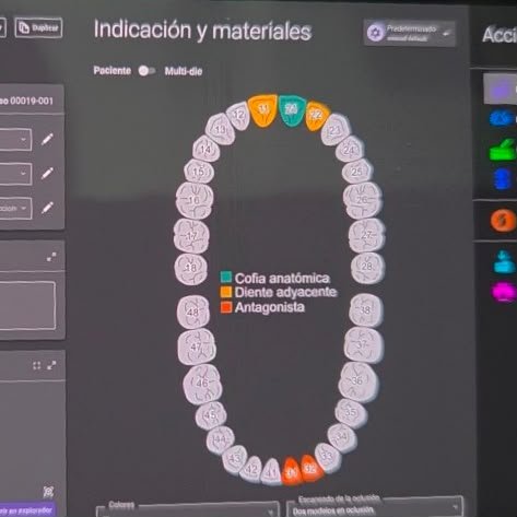 Diseño Digital CAD CAM